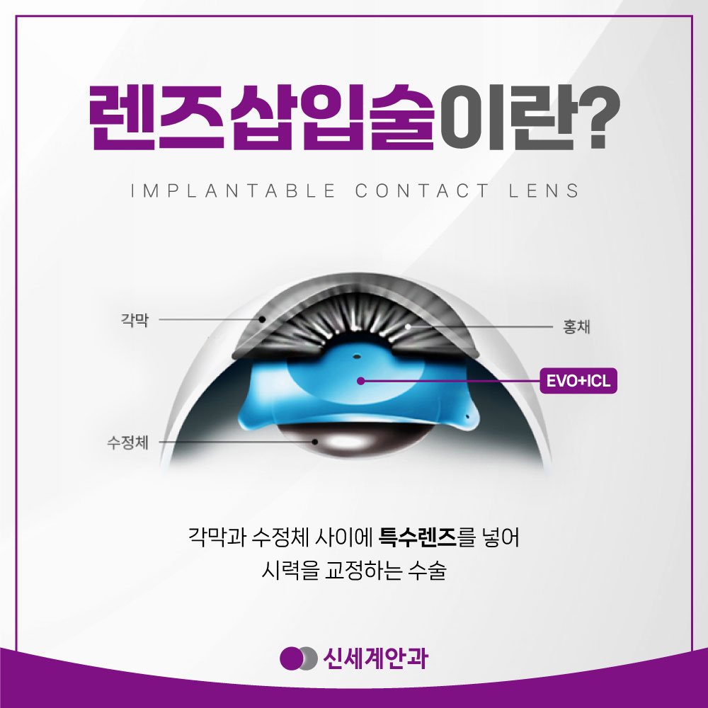 광주안과 광주안과 근시 난시 정도에 따라 알맞은 렌즈 선택을