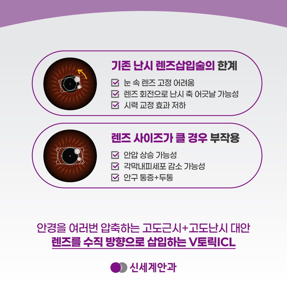 광주안과 광주안과 렌즈의 회전을 예방하려면