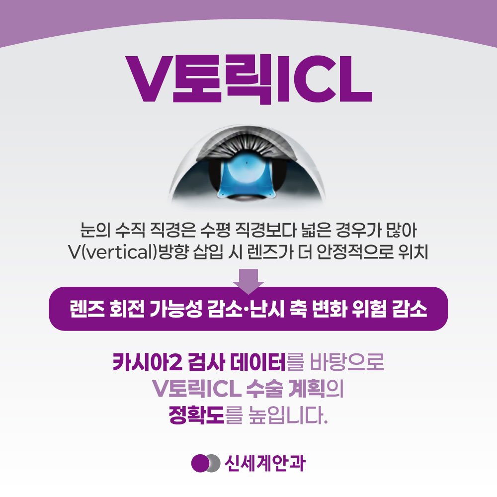 광주안과 광주안과 렌즈삽입술 난시가 있을 때 대처 방법
