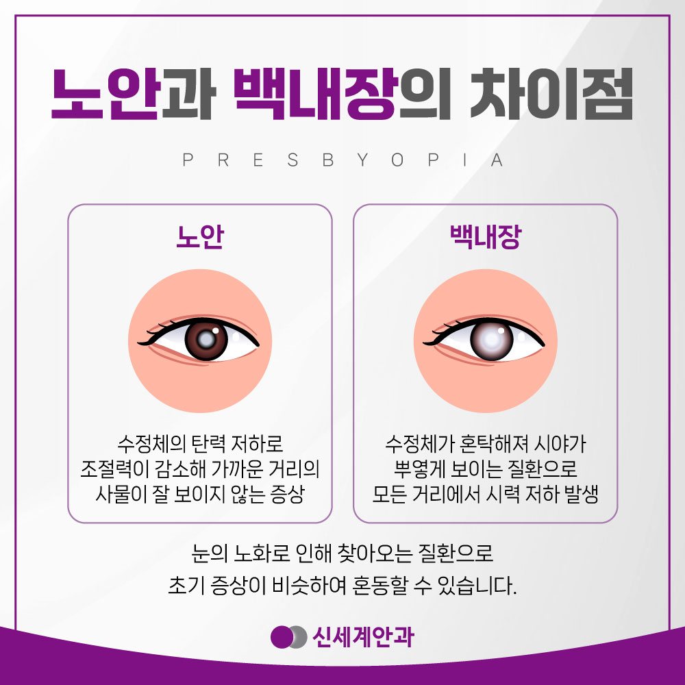 광주노안수술 안내 4