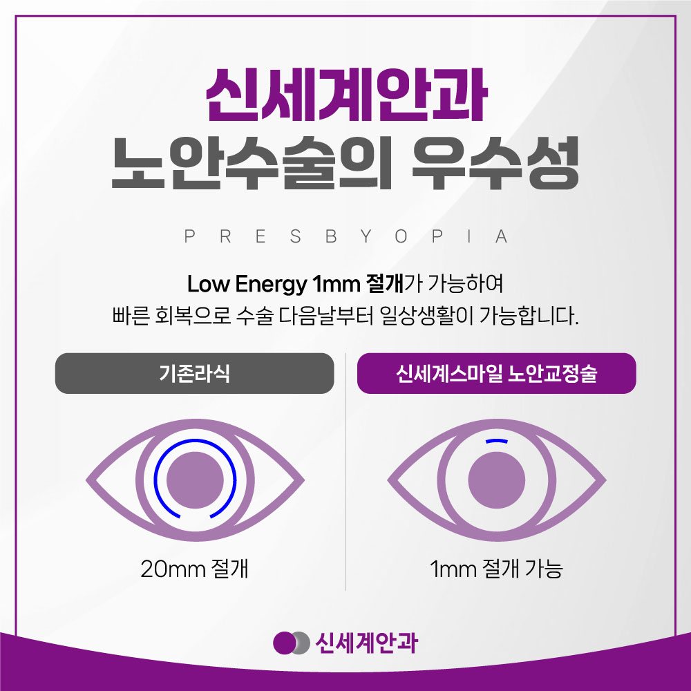 광주노안수술 안내 6