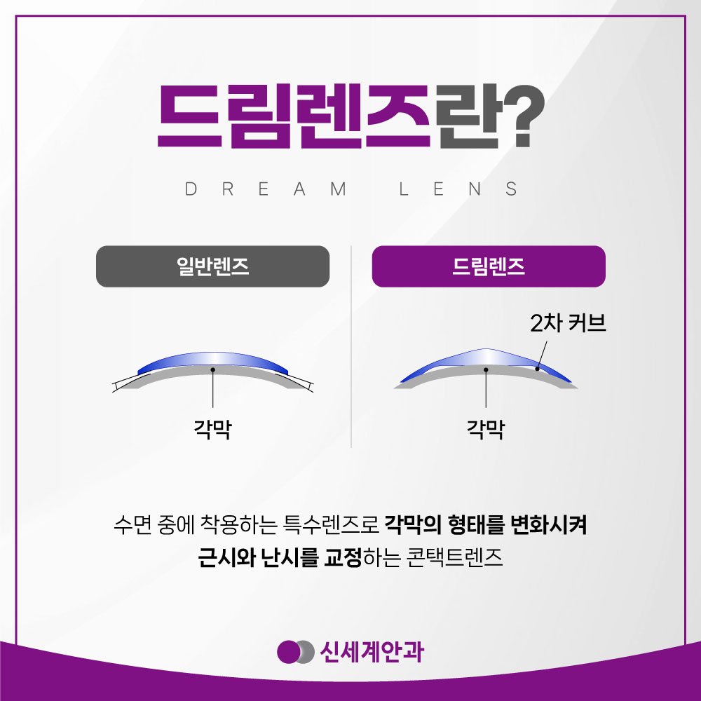 광주드림렌즈 안내 3