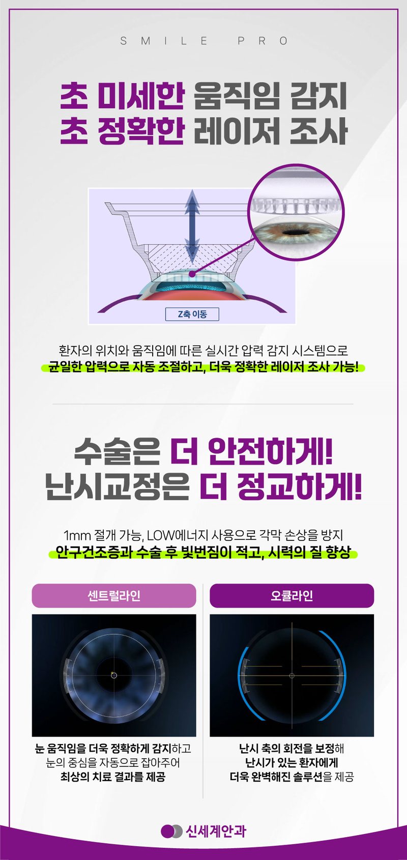 스마일프로 10초 이내 레이저